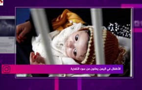 الأطفال في اليمن يعانون من سوء التغذية