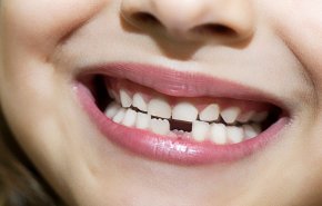 أمل للكبار والصغار.. دواء يحفز على إنبات أسنان جديدة!