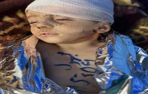 بالصورة.. طفل شهيد مجهول في مجزرة 