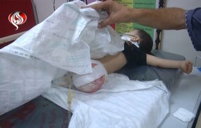 مستشفی في غزة تبتر أعضاء المصابين، لهذا السبب.. 