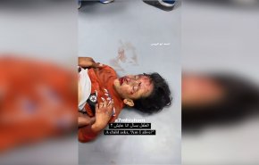 شاهد.. طفل فلسطيني أصيب في قصف الاحتلال يسأل: 