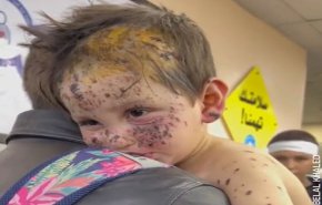 شاهد.. معاناة طفل غزاوي بريء جراء القنابل الصهيواميركية 