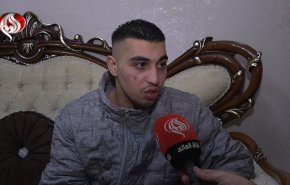 شاهد 'انسانية' الاحتلال.. اسير محرر: كسروا انفي وفتحوا وجهي!