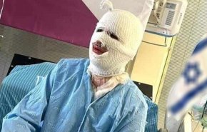 بالصورة.. جندي صهيوني 'متفحم' يثير رواد مواقع التواصل
