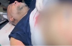 إصابة مراسل الجزيرة وائل الدحدوح ومصورها محاصر مجروح بغزة