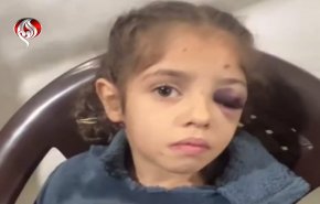 شاهد أطفال غزة بعد أن فقدوا ذويهم شهداء