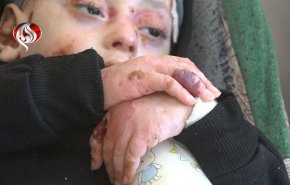 الاحتلال يجبر عائلة الطفل 'جميل' على النزوح رغم معاناته من مرض نادر