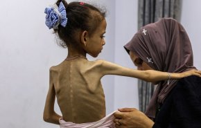مستشفيات غزة تسجل حالتي وفاة بسبب المجاعة وسوء التغذية خلال یوم