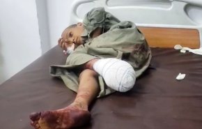 شهادت ۳ کودک و زخمی شدن دست‌کم ۱۷ نفر در حمله عربستان به مناطق مسکونی یمن+تصاویر