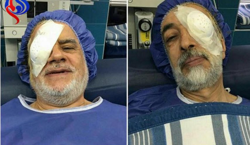 واکنش حداد عادل به عملی که وزیر بهداشت روی چشمش انجام داد