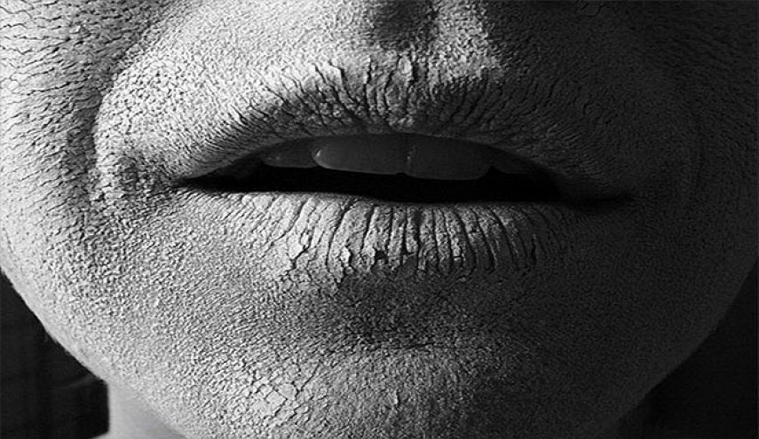 نشانه‌های كم آب شدن بدن