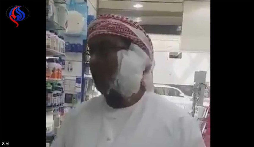 أيفون 8 الجديد ينفجر في وجه مواطن عربي! 