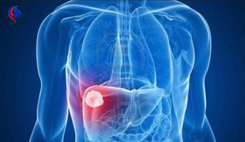 تنبيه... هذه الأعراض تشير الى تليف الكبد