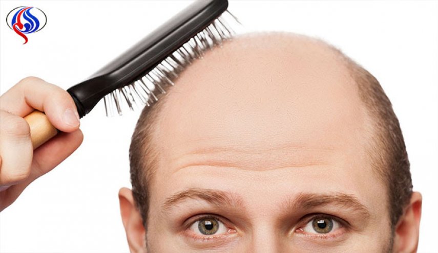 ابتكار مستحضر جديد يقضي على الصلع
