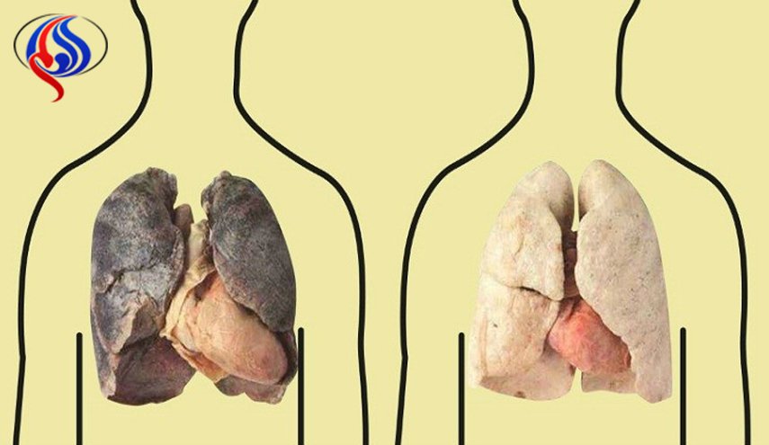 نظف رئتيك من النيكوتين بسهولة بهذه الطريقة!
