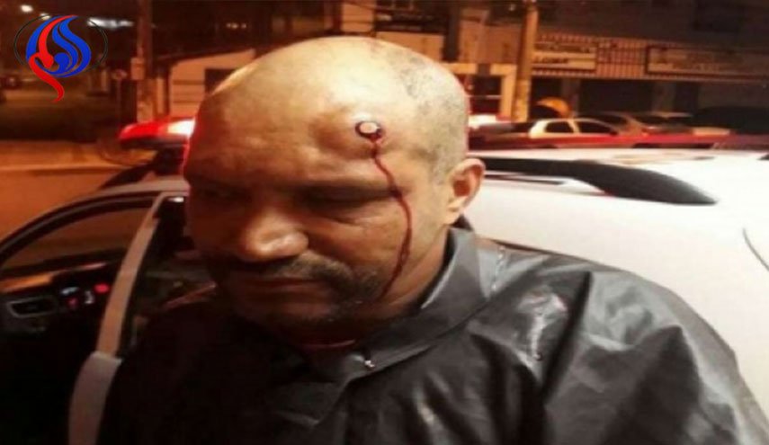كيف علقت الرصاصة في جبينه؟!.. إليك التفسيرات