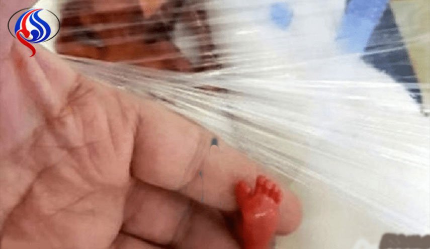 الرضيعة المعجزة.. أخف مولودة بالعالم تنجو من الموت!