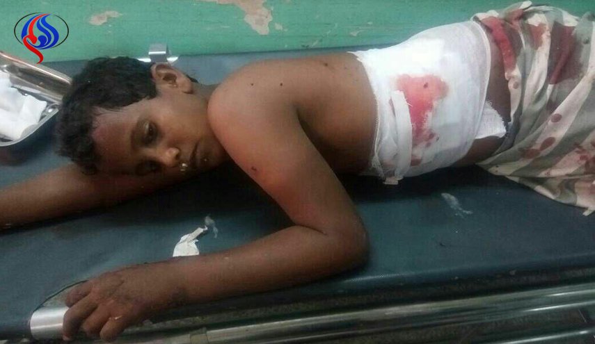 شاهد.. اصابة 3 اطفال يمنيين جراء انفجار قنبلة عنقودية