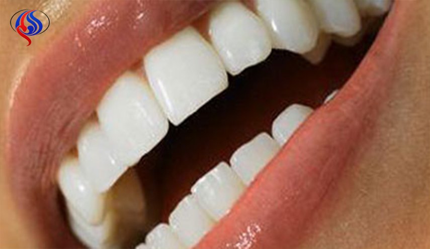 تخلص من اصفرار الأسنان حالًا، لا تؤجل الفكرة!