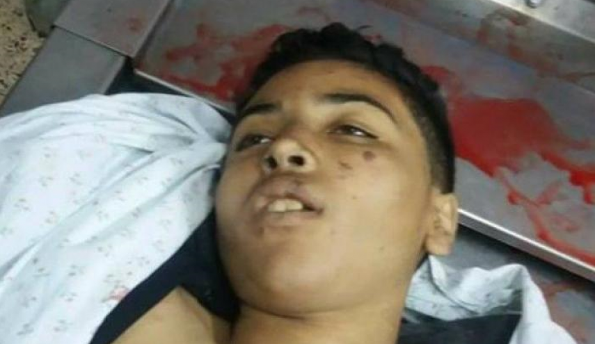 صورة..استشهاد طفل فلسطيني في غزة
