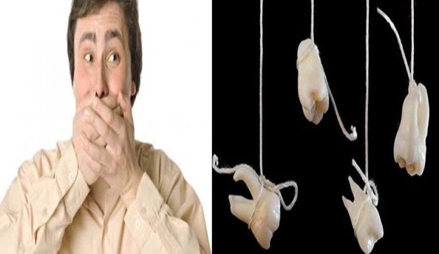 فقدان الأسنان علامة مرض قاتل!