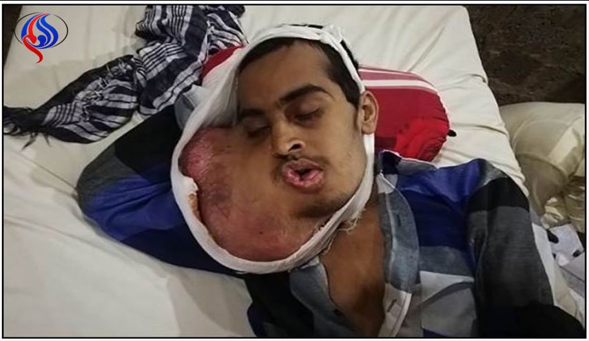 وفّر ثمن زيارة طبيب الاسنان.. والنتيجة سرطان قاتل في الفم!