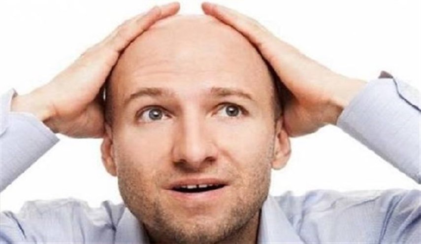 وداعا للصلع بهذه التقنية الجديدة!