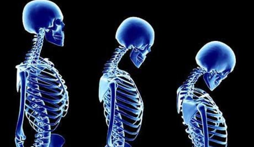 مركّب من فطر نادر يعالج هشاشة العظام