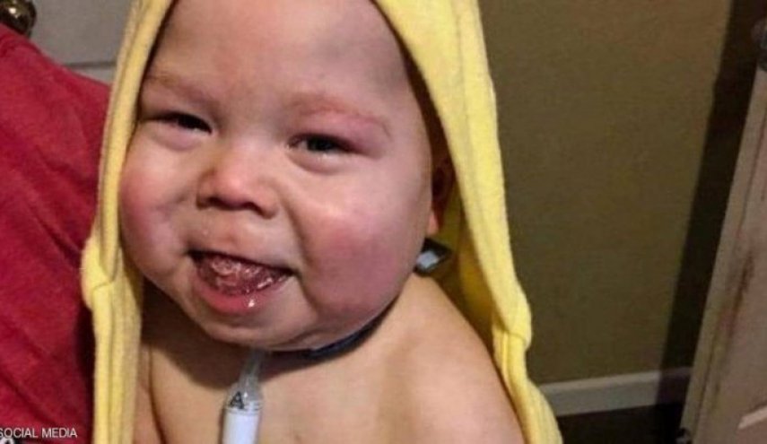 طفل ينطق مجددا بعد قطع جزء كبير من لسانه!!