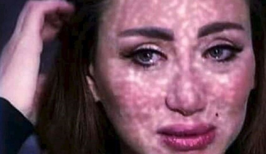 شاهد: تغييرات جذرية في وجه ريهام سعيد في أول ظهور بعد المرض!