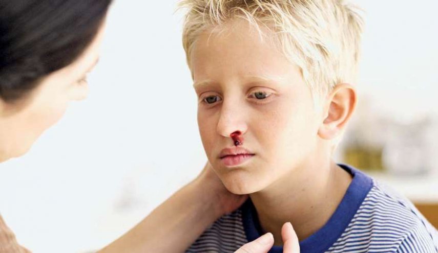 7 أسباب لنزيف الدم من الأنف وهذا علاجها ..
