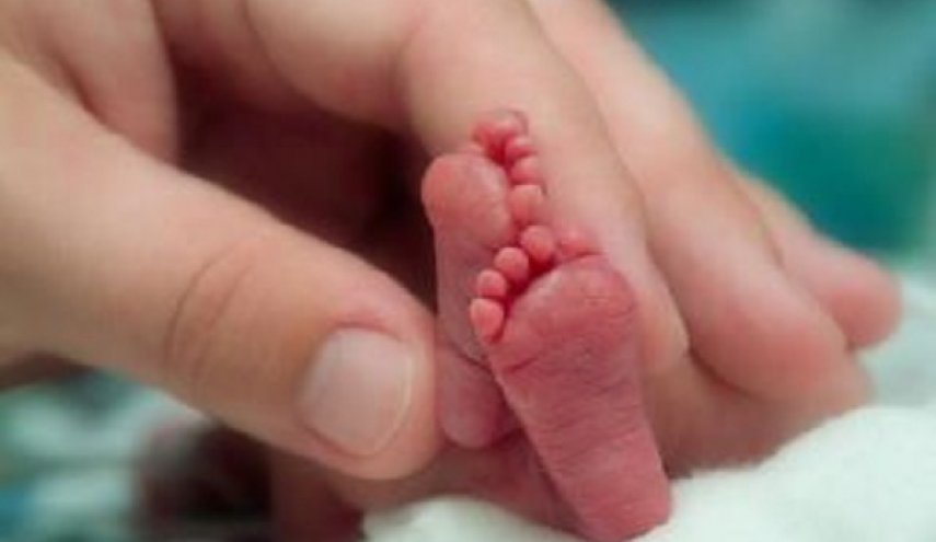 أربعة أرجل وثلاث أذرع... امرأة تنجب طفلة 'خارقة'