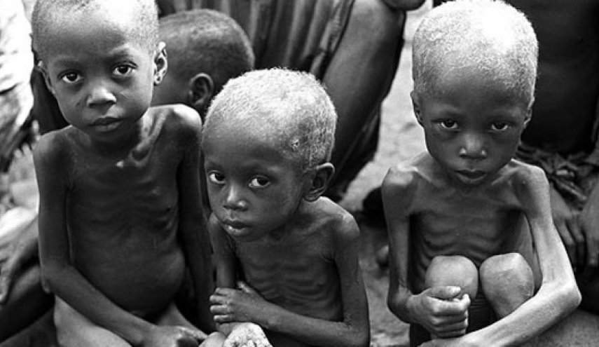 سُوء التغذية يُودي بحياة (120) طفلا يوميا في السودان