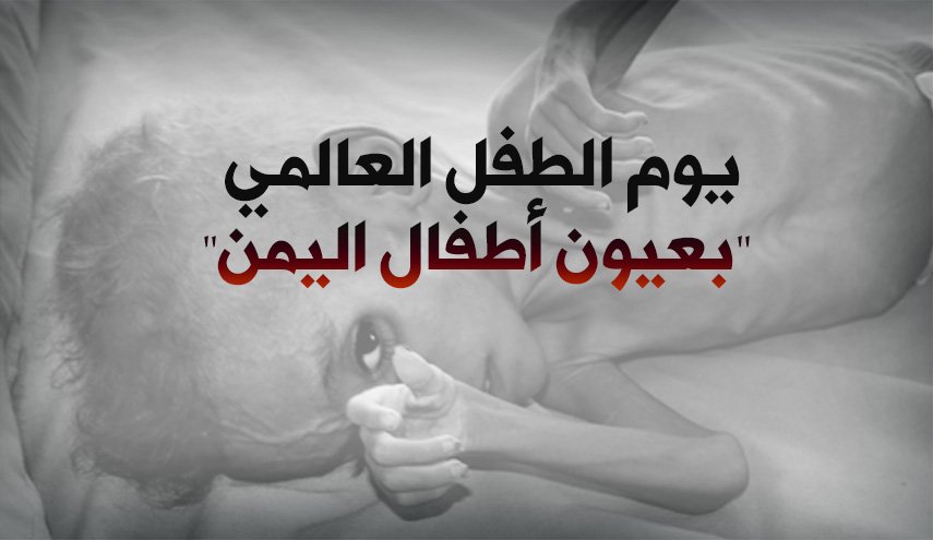 يوم الطفل العالمي ' عيون أطفال اليمن '
