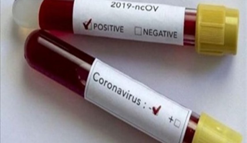 شركة معرفية ايرانية تنجح في تصنيع عدة لتشخيص كورونا