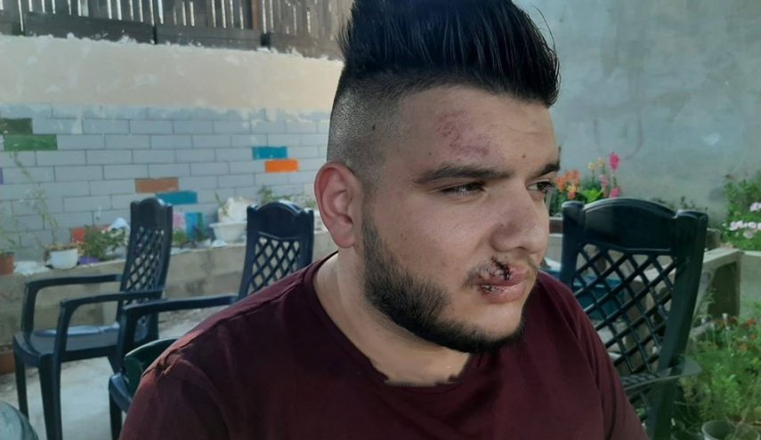 بالصور... مستوطن يطلق كلبه على سائق حافلة مقدسي