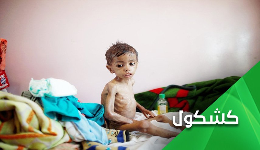 اليمن بلا نظام صحي.. وإبن سلمان يتحالف مع كورونا