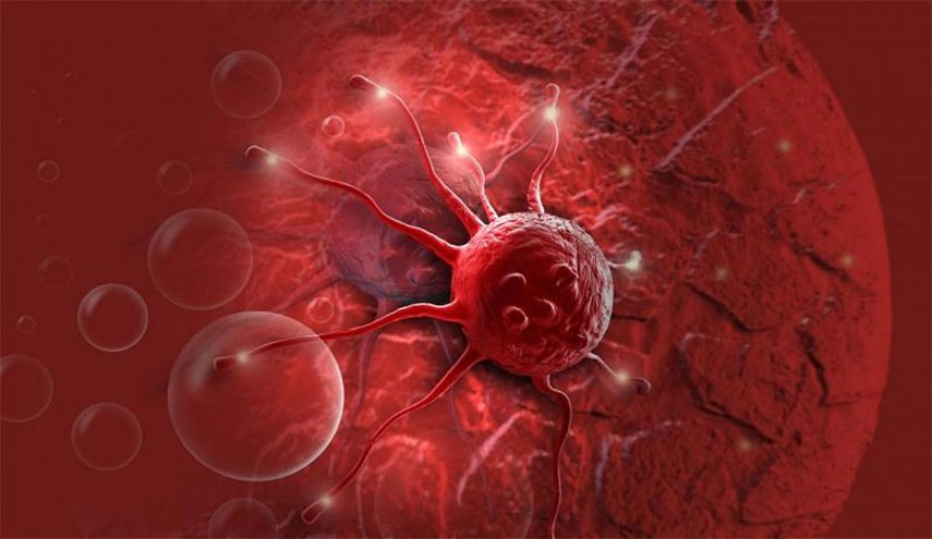 رائحة العرق غير العادية يمكن أن تكون علامة للاصابة بالسرطان 