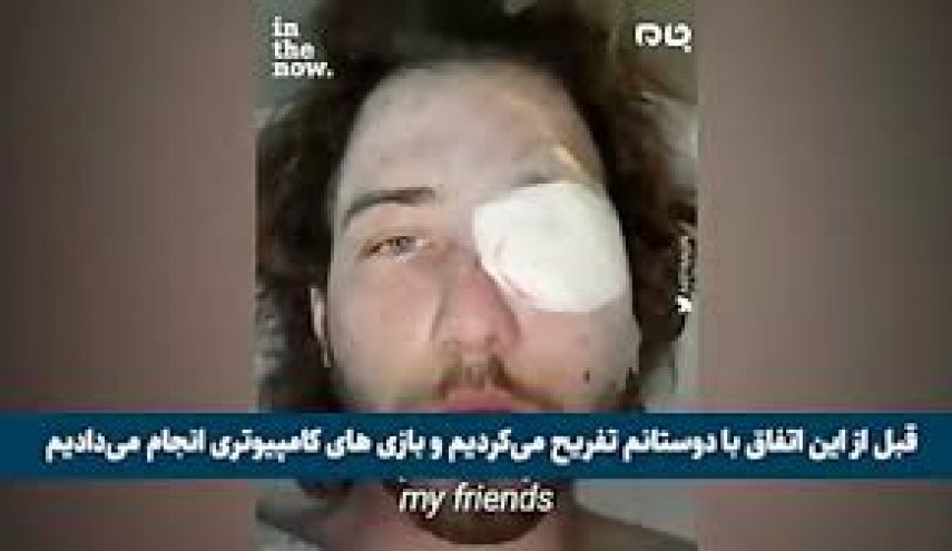 نابینایی؛ هدیه پلیس آمریکا به جوان معترض! + فیلم