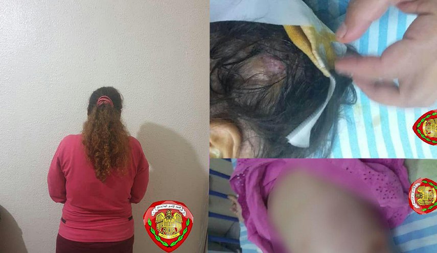 بالصور.. امرأة في جبلة تعذب طفلي زوجها بوحشية