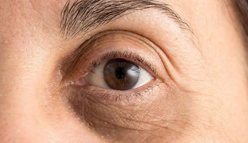 اليك طريقة بسيطة لإخفاء الهالات السوداء تحت العين