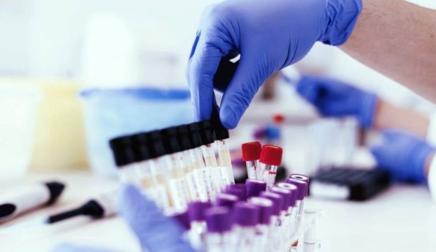 دراسة تحلل 286 سببا للوفاة وعلاقتهم بكورونا