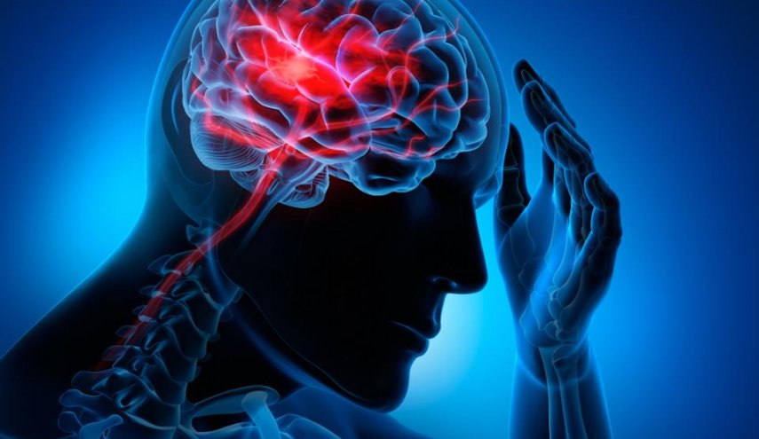 مصابو كورونا معرضون للإصابة بالسكتة الدماغية