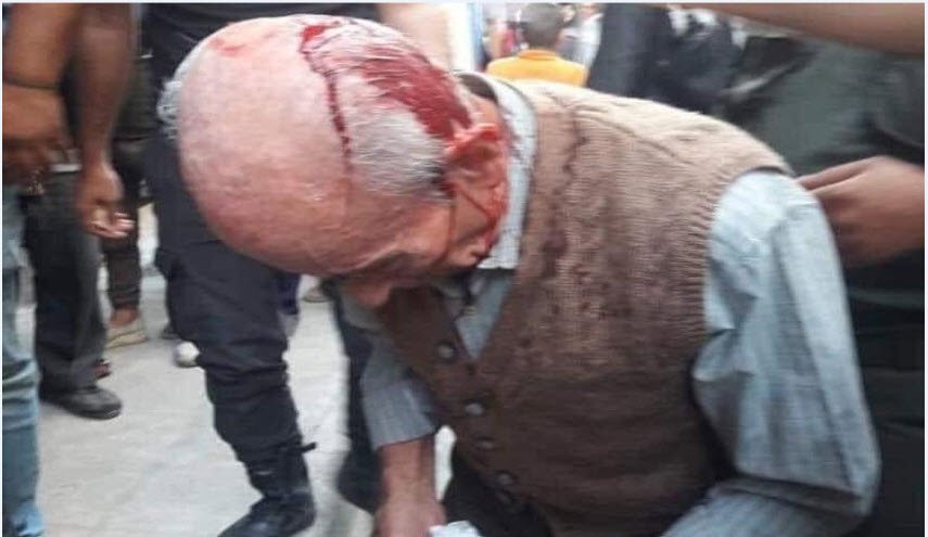 سوريا.. ما قصة الرجل المسن الذي ضرب على رأسه أمام الفرن بحلب