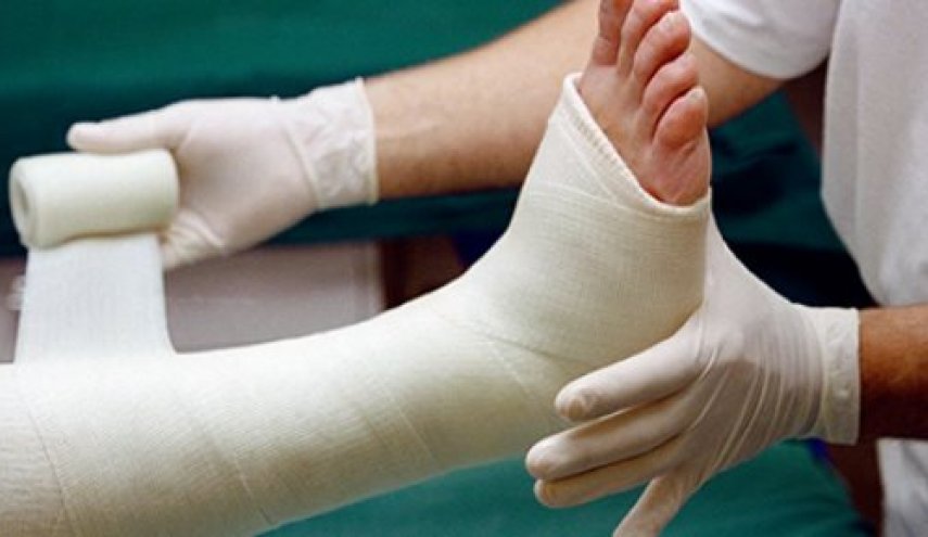تعرف على الفئة المعرضة لكسور العظام أكثر من الاخرين