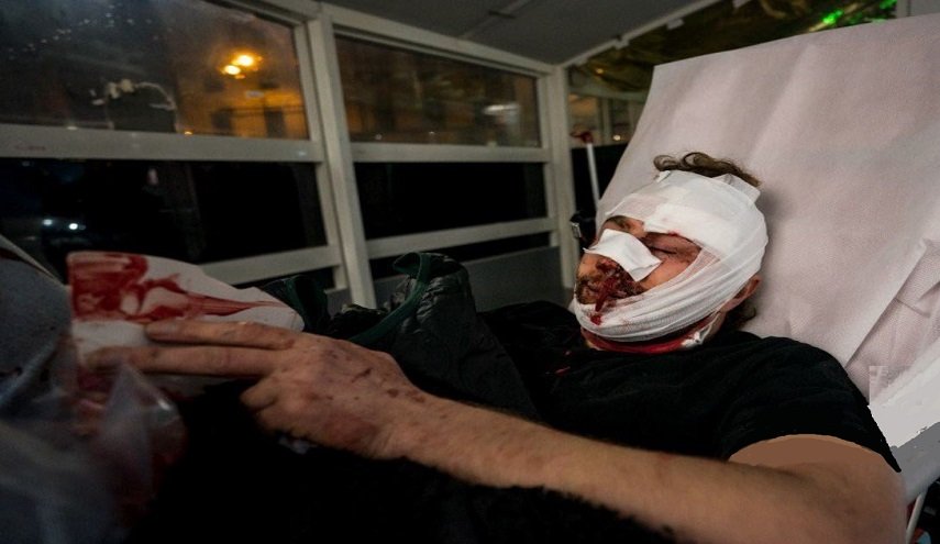 شاهد..إصابة مصور سورى أثناء احتجاجات فرنسا