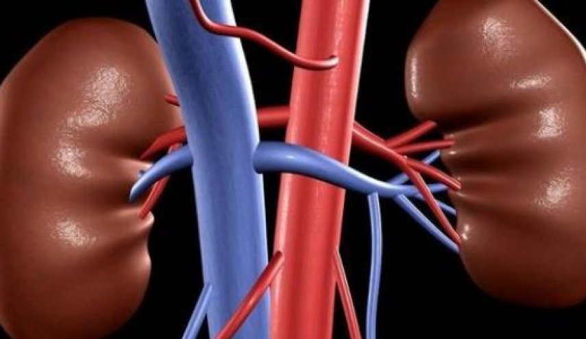 تقرير: 3 مواد غذائية تسبّب تكون الحصى في الكلى
