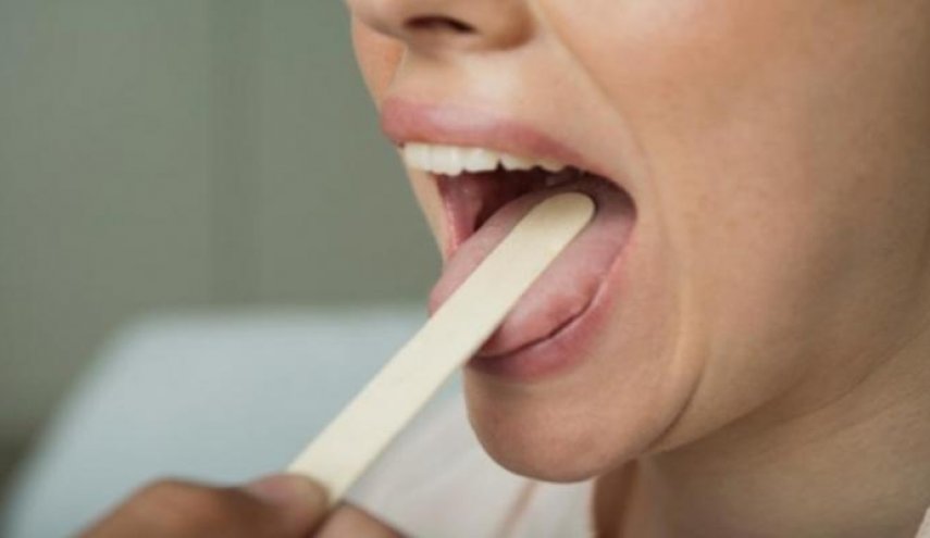 بالصورة .. يمكن اكتشاف اصابتك بكورونا من خلال لسانك