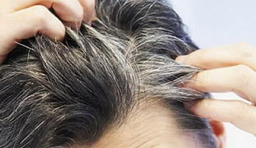 يمكن من إشارات خطيرة..ظهور الشعر الأبيض لدى الشباب!
