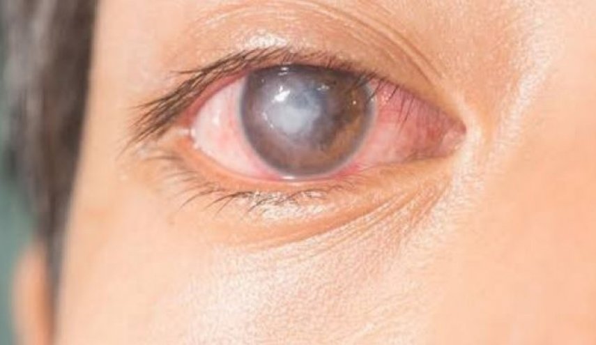إصابة رجل بقطع في قرنية العين بسبب الكمامة